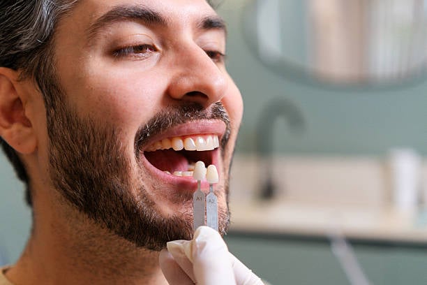 dental crown treatment
