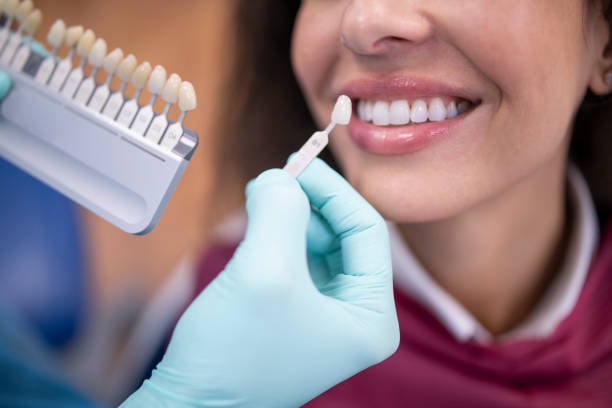 dental crowns