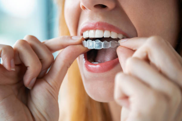 invisalign treatment in kokomo