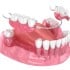 Dentures