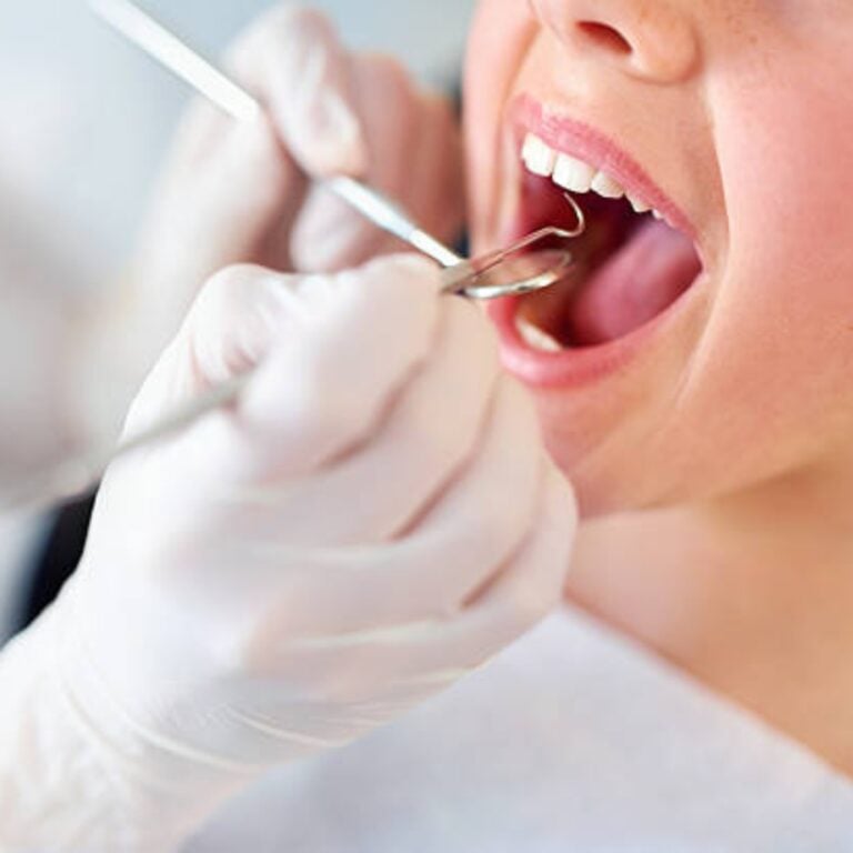 professsional dental cleaning