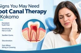 5 Signs You May Need Root Canal Therapy in Kokomo